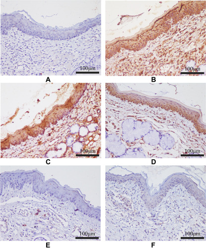 Figure 11 The effect of FFZJF aerosol on the TLR-4 protein expression in rat’s pharyngeal mucosal tissues by immunohistochemistry (400×). TLR-4 is stained brown. (A) Control group; (B) Model group; (C) FFZJF-L group; (D) FFZJF-M group; (E) FFZJF-H group; (F) AS group.