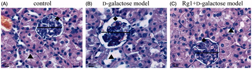 Figure 2. Effect of Rg1 on the structure of kidney glomerulus of d-galactose model mice (HE stain, ×400). Display full size: glomerulus diameter; ♦: renal capsule; ▴: renal tubular.