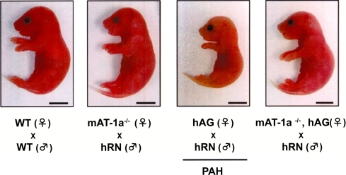 Figure 5 The effect of mAT1a blockade in PAH model. PAH fetus is shown to be significantly small in size (center right). In the fetus from hANG+/+mAT-1a−/− female mated with hRN+/+ male, the growth is markedly improved (right) (CitationSaito et al 2004).