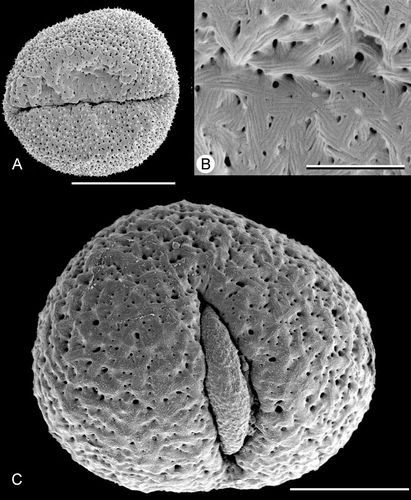 Figure 11. SEM, unusual pollen grains with(partially) striate ornamentation in Trithuria australis and T. submersa. A, B. T. australis (Macfarlane 3357 & Hearn). (A) Pollen grain viewed from distal side; a small region just above the aperture has striate ornamentation; (B) detail of striate region of the same pollen grain. C. T. submersa (Conran 961 & Rudall), pollen grain viewed from the distal side. Scale bars – 10 µm (A); 2 µm (B); 5 µm (C).