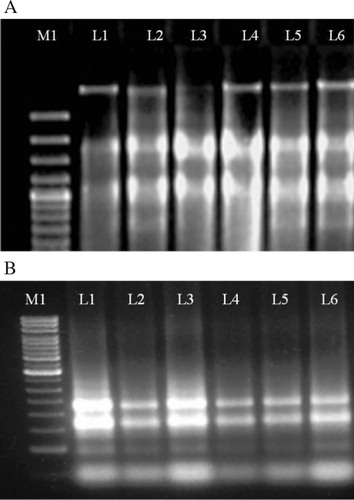 Figure 1. Total RNA isolated from leaf (A) and root (B) samples of both resistant (PJ-1430) and susceptible (SU-1080) varieties of Sorghum bicolor and electrophoresed on 0.8% agarose gel stained with EtBr. The lane M1 on the left represents 100 bp DNA ladder, lanes 2–3 RNA extracted from leaf and root of stressed samples and lanes 4–6 RNA extracted from leaf and root of control samples in A and B.