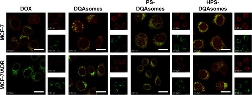 Figure 4 CLSM mitochondrial targetability of different formulations against different formulations.Notes: Green fluorescence and red fluorescence indicate MitoTracker Green and DOX, respectively. Scale bars represent 50 μm.Abbreviations: CLSM, confocal laser scanning microscopy; DOX, doxorubicin; DQA, dequalinium; HPS, HER-2 peptide-PEG2000-Schiff base.