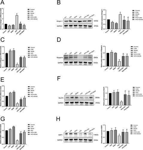 Figure 3 Liraglutide and semaglutide improved muscle atrophy and insulin resistance in HFD mice through the SIRT1 pathway. (A) The mRNA level of muscle atrophy marker Atrogin-1 was assessed by qRT-PCR. (B) The protein expression of Atrogin-1 was assessed by Western blotting. (C) The mRNA level of myogenic factor Myogenin was assessed by qRT-PCR. (D) The protein expression of Myogenin was assessed by Western blotting. (E) The mRNA level of GLUT4 was assessed by qRT-PCR. (F) The protein expression of GLUT4 was assessed by Western blotting. (G) The mRNA level of SIRT1 was assessed by qRT-PCR. (H) The protein expression of SIRT1 was assessed by Western blotting. *P < 0.05 compared with the control group, #P < 0.05 compared with the HFD group.