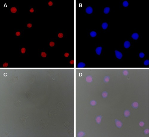 Figure 7 Fluorescence microscopy images of HeLa cells after incubation with DOX- and Pt(IV)-loaded shell cross-linked micelles for 6 h: (A) DOX (red), (B) cell nuclei stained by 4′,6-diamidino-2-phenylindole (blue), (C) bright field and (D) overlay of (A–C).Abbreviations: DOX, doxorubicin; Pt, platinum.