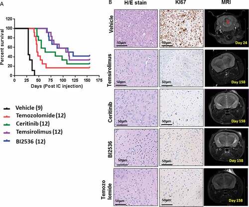 Figure 6. In vivo efficacy of selected chemotherapeutic agents against in orthotopic PDX animals. (A) Survival curves following treatment with temozolomide (15mg/kg/day, gavage, 3 days/week, 6 weeks), ceritinib (25mg/kg/day gavage, 5 days/week 5 weeks), temsirolimus (20mg/kg/day, IP, 5 days/week, 8 weeks), BI2536 25mg/kg/day, IP 2 days/week, 7 weeks) or vehicle (gavage, IP, 0.9% saline, 5% Tween80, 5% Peg400) in PDX animals. Treatments commenced 10 days after intracranial injection and endpoints were death, weight loss ≥ 20% or severe neurological decline. (B) Sections of brains from surviving animals, sacrificed at day 158 were examined histologically with H&E and immunostained for the proliferation marker Ki67. MRI depicts the absence of tumor in surviving animals at day 158, compared with controls.