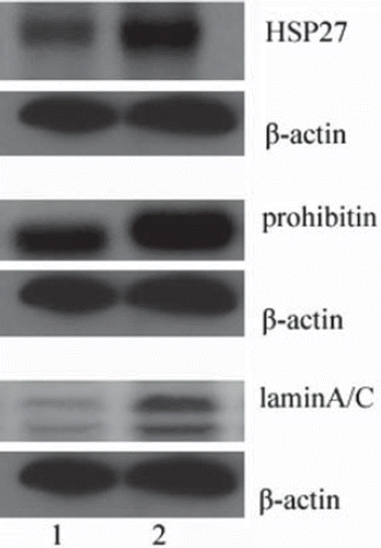 Figure 4. Western blot analysis of the Hsp27 (A), prohibitin (B) and laminA/C (C) in normal breast (Lane 1) and breast carcinoma (Lane 2). β-actin was used as an internal loading control.