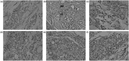 Figure 11. Effect of total glycosides from P. hookeri on histopathology of synovium in AA rats. (a) Normal synovial tissue, (b) synovial tissue of AA rats treated with vehicle showed obvious inflammatory cell infiltration (**) and synovial hyperplasia (##), (c) synovial tissue of AA rats treated with nimesulide (33.33 mg/kg), (d–f) synovial tissue of AA rats treated with 14, 28 and 56 mg/kg of total glycosides from P. hookeri, respectively. Panels c, d, e and f show reduction in inflammatory cell infiltration and synovial hyperplasia (original magnification  400×).