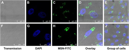 Figure 4 MSN nanocarriers were efficiently internalized by cells.Notes: Cellular uptake of MSN nanocarriers in fixed MDA-MB-231 cells. (A–E) Uptake after 24 h incubation. (F–J) Uptake after 48 h incubation.Abbreviations: MSN, mesoporous silica nanoparticle; FITC, fluorescein isothiocyanate.