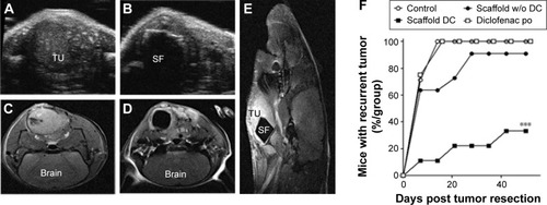 Figure 2 Visualization of recurrent tumor by sonography and MRI following resection of the primary tumor.Notes: (A) Representative sonographic visualization of recurrent tumor in a mouse from the untreated group and (B) from the scaffold without diclofenac group. (C) Axial MRI visualization of a recurrent tumor in a mouse from the untreated group and (D) from a scaffold without diclofenac group. (E) Sagittal MRI of mouse from the scaffold without diclofenac group showing scaffold and recurrent tumor. (F) Temporal detection of tumor recurrence in experimental groups. The group with diclofenac-releasing scaffolds had fewer mice with recurrent tumor. At the end of 7 weeks following tumor resection, only 33% of mice in this group had recurrent tumor, in comparison to 90%–100% of the mice in the three other groups. Control n=8, scaffold without diclofenac n=10, diclofenac-loaded scaffold n=9, and diclofenac po n=10 (after 10 days n=4). ***P<0.001.Abbreviations: MRI, magnetic resonance imaging; TU, tumor; SF, scaffold; DC, diclofenac.