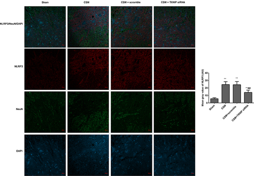 Figure 7 Inhibition of TXNIP declined the NLRP3 expression in the anterior horn of the lesioned area following CSM. The mean fluorescence intensities of NLRP3/NeuN were analyzed by immunofluorescence. The mean gray values were analyzed by Image J software. Compared with the sham group, **P<0.01; compared with the scrambled group, ##P<0.01.