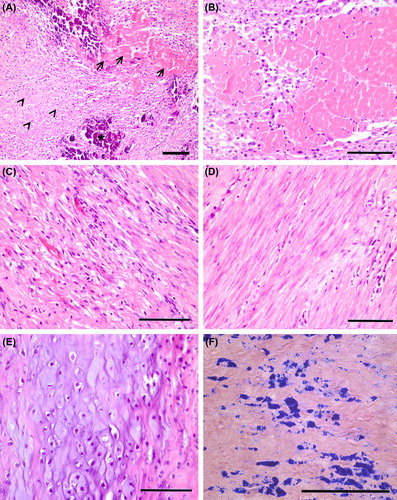 Figure 4. Histological changes in myocardium after 3 weeks of AMI. (A) Mainly fibrosis (arrow heads) but also necrosis (arrows) and calcification (asterix) were observed in an injured area of both BMMNC group and control group animals. (B) Necrosis was detected in a few segments, but mainly there was granulation tissue with newly formed fibrosis (C) or fibrotic scar (D, E) Cartilage was also found in the myocardium of both controls and BMMNC group animals. (F) Prussian blue staining detected the SPIO-labeled BMMNCs. (A–E) H&E staining, scale bars 100 μm.