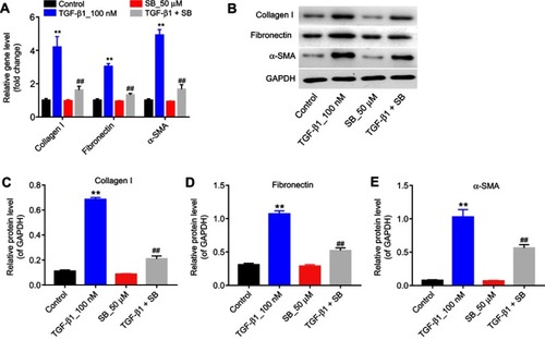 Figure 2 Silibinin reversed TGF-β1-induced fibrosis of endothelial cells in vitro. (A) The mRNA levels of collagen I, fibronectin, and α-SMA were measured by RT-qPCR, when HRGECs incubation with 100 nM TGF-β1 or/and 50 μM silibinin for 72 hrs. (B) The protein expression of collagen I, fibronectin, and α-SMA was examined by Western blot. GAPDH was used as an internal control. The relative protein expression of (C) collagen I, (D) fibronectin, and (E) α-SMA normalized to GAPDH was quantified. Each sample was tested in triplicate. **P<0.01 vs control group; ##P<0.01 vs TGF-β1 group.