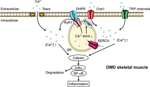 Figure 1 The hypothetical mechanism of Ca2+ overflow-induced inflammation response in DMD muscles.