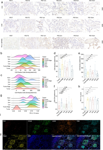 Figure 2. Immunohistochemistry on T cell markers in tumor, tumor edge, 1 cm, 2 cm, 5 cm, and 10 cm adjacent normal tissues of early NSCLC patients. a: the representative images of immunohistochemical staining on CD4, CD8, and PD-L1 in tumor, tumor edge, 1 cm, 2 cm, 5 cm, and 10 cm adjacent normal tissues. b: CD8+ cell density (cells/mm2) measured by IHC across all tissues for n = 4 patients. c: CD4+ cell density (cells/mm2) measured by IHC across all tissues for n = 4 patients. d: Boxplot represents the comparison of CD8+ cell density across all tissues. Mann-Whitney U-test was used for statistical analysis. e: Boxplot represents the comparison of CD4+ cell density across all tissues. Mann-Whitney U-test was used for statistical analysis. f: Median CD8+: CD4+ cell densities (cells/mm2) across all regions for n = 4 patients. g: PD-L1 score measured by IHC across all tissues for n = 4 patients. h: Boxplot represents the comparison of PD-L1 score across all tissues. Mann-Whitney U-test was used for statistical analysis. i: the representative images of multiplex immunohistochemistry show the expression of CKpan, TIM3, PD1, LAG3, and CTLA4 in tumor, tumor edge, and 1 cm, 2 cm, 5 cm, and 10 cm adjacent normal tissues. Scale bar, 100 μm.