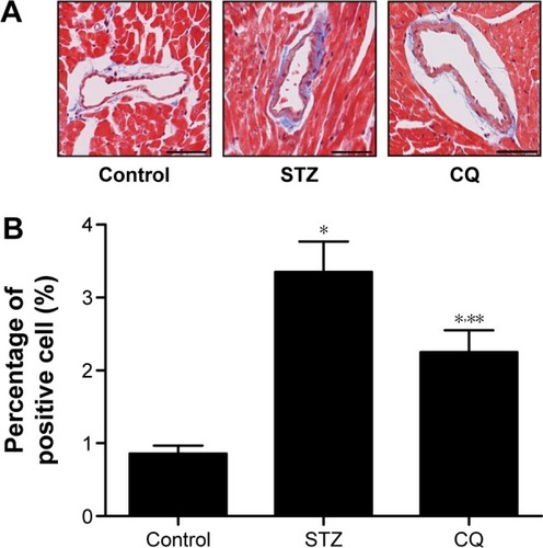 Figure 8 Effects of CQ on cardiac fibrosis in STZ-induced mice.