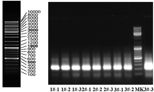 Figure 1. PCR amplification results