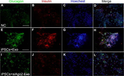 Figure 6 Immunofluorescence assays for glucagon and insulin expression at the late stage. Representative images of co-immunostaining of glucagon (green) and insulin (red), nuclear Hoechst staining is shown in blue. iPSCs cultured with knockout DMEM (A–D), iPSCs cultured with differentiation medium containing exosomes (E–H), iPSCs cultured with differentiation medium containing si-Ago2 exosomes (I–L). Scale bar = 50 μm.