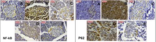 Figure 11 Immunohistochemical staining of NF-κB and p62 respectively showing (A) negatively stained normal control (B) PCOS group showing extensively positive staining (C) Clomiphene group showing weak staining (D) NC-100 group showing weaker staining compared to PCOS & (E) NC-200 group showing weak staining. (Magnification X400).