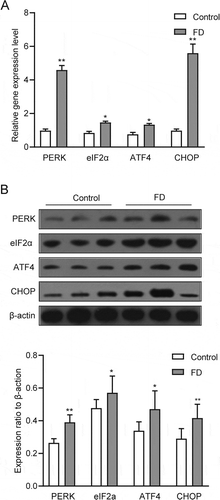 Figure 3. Folic acid deficiency could activate the PERK signaling pathway of ER stress. (A) RT-qPCR analysis of PERK, eIF2a, ATF4 and CHOP in testicular tissues. (B) Western blot analysis of PERK, eIF2a, ATF4 and CHOP in testicular tissues. Control, control group; FD, folic acid-deficient group. All experiments were performed n = 6 in replicates. Data were presented as mean ± SEM; *P < 0.05, **P 0 < .01
