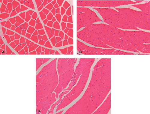 Figure 4. Images of the transverse section of the tibialis anterior muscle, following hematoxylin and eosin staining (X200), compared with the contralateral normal muscle (A). Different degrees of muscle atrophy were seen in the operated side of the experimental (B) and control groups (C).