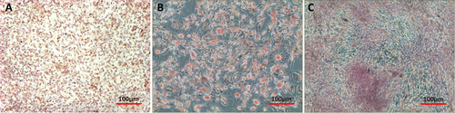 Figure 2. Multilineage differentiation of SMSCs. (a) After incubation in chondrogenic medium SMSCs were positively stained for collagen II protein (immunostaining). (b) After incubation in adipogenic medium SMSCs were positively stained for adipose drops (Oil Red O). (c) After incubation in osteogenic medium SMSCs were positively stained for calcium matrix (Alizarin Red).