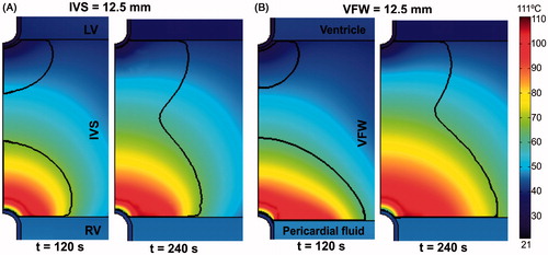 Figure 10. Temperature distributions in the tissue after 120 s and 240 s of RFA with SeUM across the IVS (A) and the VFW (both 12.5 mm thickness). The solid black line is the thermal damage border (Ω = 1).