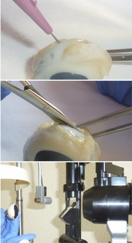 Figure 1 Eyes were cut and divided in two portions. We first performed a penetrating incision parallel to the limbus with a scalpel (top); then, we completed the cut around the globe with Westcott scissors (center); finally, slit-lamp photographs of the internal sides of the sclerotomies were taken (bottom).