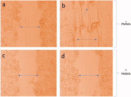 Figure 8. Effect of PMMA on wound healing. Wound healing assays of PMMA was performed in HCT-116 cells. These are representative photographs of (a) non-treated HCT-116 with scratch 0 h, (b) non-treated HCT-116 cells after 24 h, (c) PMMA-treated cells (7.5 μg/mL) 0 h and (d) PMMA-treated cells (7.5 μg/mL) 24 h. Figure (b) shows healing of cells after 24 h, whereas (d) shows no-healing after 24 h. 400× magnifications.