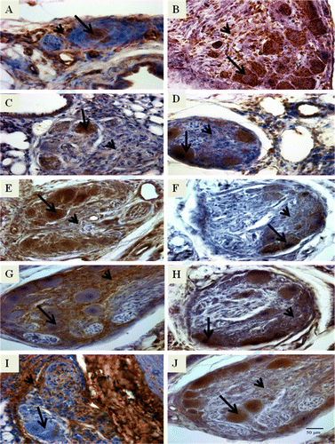Figure 2.  Photomicrographs of immunostained lung sections from IPAH-susceptible broilers showing positive staining for angioproliferative molecules that include (2A) vWF, (2B) αSMA, (2C) VEGF, (2D) VEGFR-2, (2E) HIF-1α, (2F) survivin, (2G) tenascin, (2H) fibronectin, (2I) collagen type III, and (2J) collagen type IV. It must be noted that we examined the lung sections from 8-week-old to 24-week-old broilers. The lung sections presented here are from 12-week-old broilers except for VEGFR-2 (20 weeks old). The brown-coloured reaction product indicates positive staining. For each molecule, the foam-type macrophages are indicated by an arrow and the matrix of intimal proliferating cells by an arrowhead. Original magnification ×400, scale bar =50 µm.