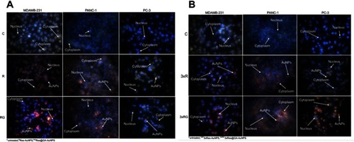 Figure 10 (A) Cellular internalization of Res-AuNPs and Res-GA-AuNPs in breast (MDAMB-231), pancreatic (PANC-1) and prostate (PC-3) cancer cell lines incubated for 24 hours at 42 µg/mL. (B) Cellular internalization of 3× Res-AuNPs and 3× Res-GA-AuNPs in MDAMB-231, pancreatic and prostate cancer cell lines incubated for 24 hours at 42 µg/mL.Abbreviations: Res, resveratrol; AuNPs, gold nanoparticles; GA, gum arabic.