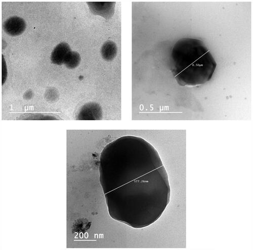 Figure 2. Transmission electron micrographs of the tenoxicam-nanostructured lipid carriers (TNX-NLCs, F4).