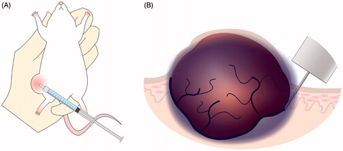 Figure 1. (A) Image of administering 5-FU around an artificially generated cancer tissue using a hollow micro needle. (B) A sustained 5-FU sol-gel formulation (purple area) was administered around the tumor to deliver the drug into the tumor.