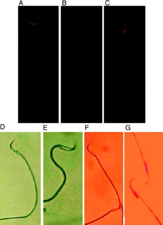Figure 2.  Representative profile of sperm shape in various staining techniques. A) light green fluorescent architecture from normal sperm with double strand DNA; B) light yellow fluorescent from sperm with partly denatured single-stranded DNA; C) reddish fluorescent from sperm with single strand DNA; D) sperm with immature chromatin condensation; E) sperm with condensed chromatin; F) live sperm with colorless cytoplasm; and G) dead sperm with stained cytoplasm. A-C) acridine-orange staining, D-E) aniline-blue staining, and F-G) eosin-nigrosin staining