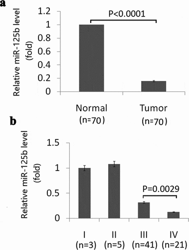 Figure 1. Expression of miR-125b in EOC tissues and its relation with tumor stage. (a), Expression of miR-125b in EOC tissues and matched adjacent noncancerous tissues by qRT-PCR analysis (p < 0.0001). (b), Expression of miR-125b in different stages in EOC tissues by qRT-PCR analysis (p = 0.0029).