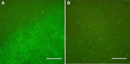 Figure 6 Live/dead assay of Staphylococcus epidermidis attached on PEEK (A) and PEKK (B) samples (SYTO® 9 and propidium iodide respectively stained live [green] and dead [red] bacteria cells).
