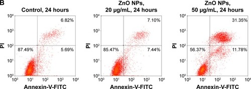 Figure 7 ZnO NPs induced HaCaT cell apoptosis.Notes: (A) Scanning electron microscopy images of HaCaT cell topography after exposure to ZnO NPs for 24 hours at different concentrations. The normal HaCaT surface was covered by abundant microvillus, whereas after exposure to ZnO NPs, the microvillus was decreased significantly. Compared to normal HaCaT cells, the apoptotic body appeared (white arrows) on the surface of treated cells. Scale bars =10 μm. (B) Flow cytometry results of Annexin-V-FITC and PI assay. HaCaT cells were treated without (control) or with ZnO NPs (20 or 50 μg/mL) for 24 hours. A cell stained by Annexin-V-FITC− and PI− is shown in the lower left area, one stained by Annexin-V-FITC+ and PI− is shown in the lower right area, one stained by Annexin-V-FITC− and PI+ is shown in the upper left area, and one stained by Annexin-V-FITC+ and PI+ is shown in the upper right area.Abbreviations: ZnO NPs, zinc oxide nanoparticles; FITC, fluorescein isothiocyanate; PI, propidium iodide.