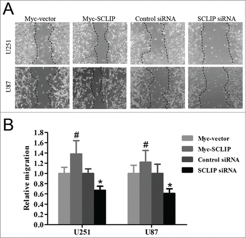 Figure 5. SCLIP promotes migration of U251 and U87 cells. (A) Migration of indicated cell lines was conducted with cell wound healing assay as described in Materials and Methods. (B) Quantification of cell migration from the indicated cell lines was performed. Values are the average of triple determinations with the SD indicated by error bars. Myc-SCLIP vs. Myc-vector, #P<0.05; SCLIP siRNA vs. Control siRNA, *P <0.01.