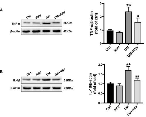 Figure 4 RSV prevents T2DM-induced hippocampal inflammation. (A, B) The levels of the inﬂammatory factors TNF-α (A) and IL-1β (B) were measured by Western blotting. The data are expressed as the mean ± SD (n = 3). **P < 0.01 vs Ctrl; #P < 0.05, ##P < 0.01vs. DM.Abbreviations: TNF-α, tumor necrosis factor-α; IL-1β, interleukin-1β.