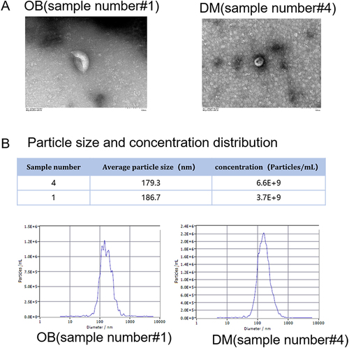 Figure 1 Characterization of plasma exosomes. Plasma exosomes were isolated from obese and non-obese patients with type 2 diabetes. (A) The morphology of plasm exosomes from sample 1 and sample 4 under a transmission electron microscope. Magnification 6000 ×. (B) Particle size was measured using nanoparticle tracking analysis.