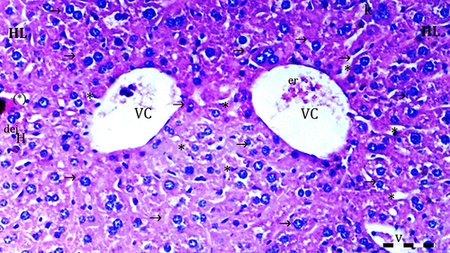 Figure 5 Representative light microscopy of hepatic tissue from DIR-S group. Scale bar 50 µm, H&Ex100.