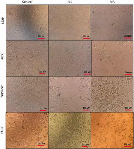 Figure 6. Cell images of cytotoxic effect of microalgal oil extracts (375 µg/ml) on L929, AGS SHSY-5Y and PC-3 cancer cells.