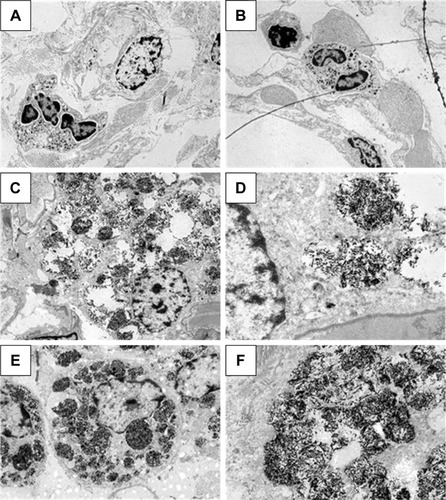Figure 6 TEM of lung-tissue macrophages from groups C (A), VT (B), LD (C, D), and HD (E, F).Notes: Magnification: left, 3,000×; right, 12,000×. (D, F) Nanorods within multivesicle bodies can be recognized.Abbreviations: C, control; HD, high dose (18 mg/kg body weight); LD, low dose (5 mg/kg body weight); TEM, transmission electron microscopy; VT, vehicle-treated.