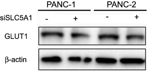 Figure S2 Knockdown of SLC5A1 has no significant effect on GLUT1 expression. Panc-1 and Panc-2 cells expressing siRNA against SLC5A1 was collected for immunoblotting. No significant change on GLUT1 expression in both cells was observed after SLC5A1 knockdown.