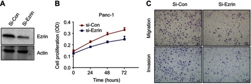 Figure S1 Knockdown of Ezrin inhibits cell proliferation, invasion, and migration of Panc-1 cells. (A) Efficiency of Ezrin knockdown in Panc-1 cells by siRNA was verified by Western blot. (B) Effect of Ezrin knockdown on viability of Panc-1 cells was measured by MTT assay. (C) Influence of Ezrin knockdown on migration and invasion of Panc-1 cells was determined by transwell assay.Abbreviation: Con, control.