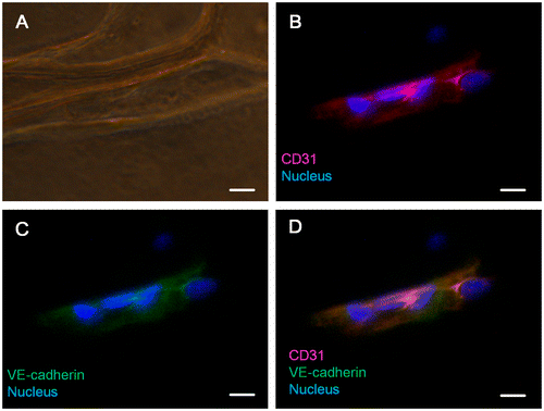 Figure 6. Immunofluorescent staining of CD31 and VE-cadherin. (A) Bright-field image. (B) Merged image of the nucleus and CD31. (C) Merged image of the nucleus and VE-cadherin. (D) Merged image of the nucleus, CD31 and VE-cadherin. Scale bar: 25 μm.