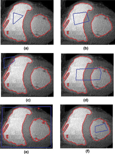 Figure 3. Contour evaluation using different types of initialization.