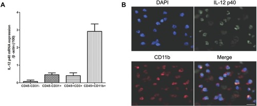 Figure 2 IL-12 p40 is mainly localized in monocytes. (A) RT-PCR analysis of IL-12 p40 mRNA in different cell types in cerebral hemorrhage tissue at 7 days after ICH; (B) Immunofluorescence analysis of IL-12 p40 and CD11b protein expression in cerebral hemorrhage tissue at 7 days after ICH. Seven rats per group.