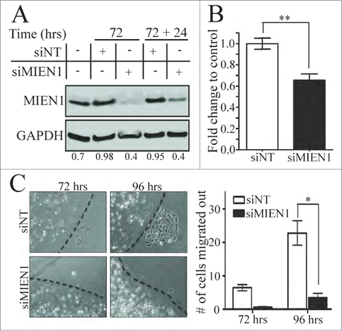 Figure 2. Knocking down MIEN1 reduces the migratory and invasive potential of OSC-2 cells. (A) Western blotting shows MIEN1 expression upon siNT or siMIEN1 transfection, 72 hours after transfection and the MIEN1 expression after re-seeding at 72 hours (72+24 hours after transfection) normalized to GAPDH. (B) Quantification of invasive potential of transfected cells 24 hours after re-seeding transfected cells (cells were trypsinized 72 hours after transfection and re-seeded for 24 hours, totaling to 96 hours after transfection) on inserts. (C, left) Representative images of agarose beads at the respective time points after re-seeding siNT or siMIEN1 transfected cells (cells were trypsinized, counted and seeded 24 hours after transfection; images were captured at the respective time points from the point of bead formation); (C, right) Quantification of the number of cells migrated out from 10 fields between 3 technical replicates and averaged between 2 such independent experiments.