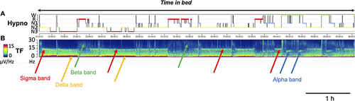 Figure 3 EEG Time-Frequency Analysis During Sleep Recording. Hypnogram obtained from AASM recommended sleep staging in (A and B) shows the corresponding spectrogram trend of EEG frequency measured on C4-M1 channel derived from a fast Fourier transform analysis. Color-bar indicates the power of EEG frequency (µV/Hz with the lowest power in dark blue and the highest power in red), the y-axis indicates the EEG frequency (from 0 to 30 Hz) and the x-axis indicates time. The EEG signatures of NREM include an increase in the delta band below 2 Hz (Orange arrows, compatible with slow waves) and in the sigma band around 15 Hz (red arrows, compatible with spindle activity). The power of delta activity decreases across the night along with the decrease of homeostatic pressure. An increase in beta activity is observed in REM sleep (green arrows). At the end of the recording, note the EEG activity in the alpha band around 10 Hz (blue arrows, compatible with quiet wakefulness eyes closed).