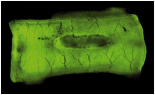 Figure 1. Jejunum sample with cautery lesion under fluorescence camera, after fluorescein injection.